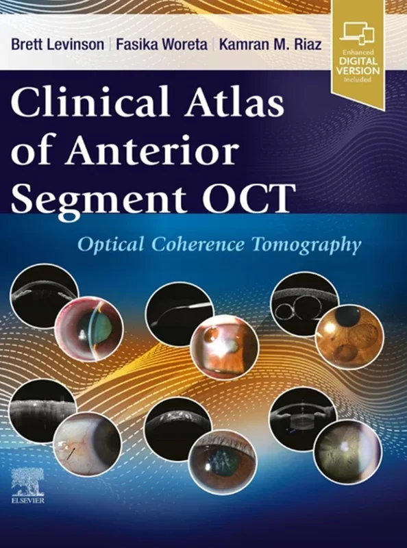 Clinical Atlas of Anterior Segment OCT: Optical Coherence Tomography